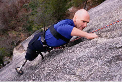 幻肢痛的心理治疗方法,幻肢痛治疗手段