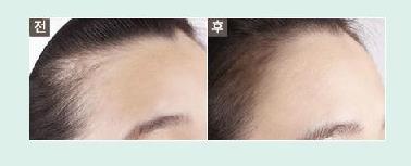 盘点女星被拍到的纯素颜 (女明星真假素颜对比)