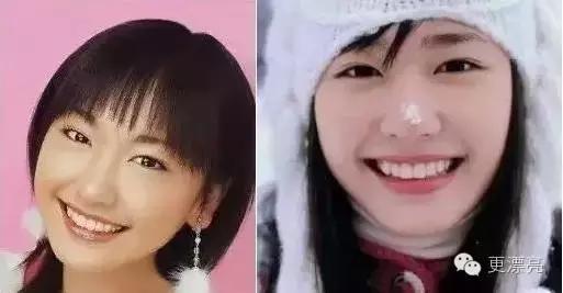 日本整形与韩国整形对比,为什么日本整形不如韩国整形