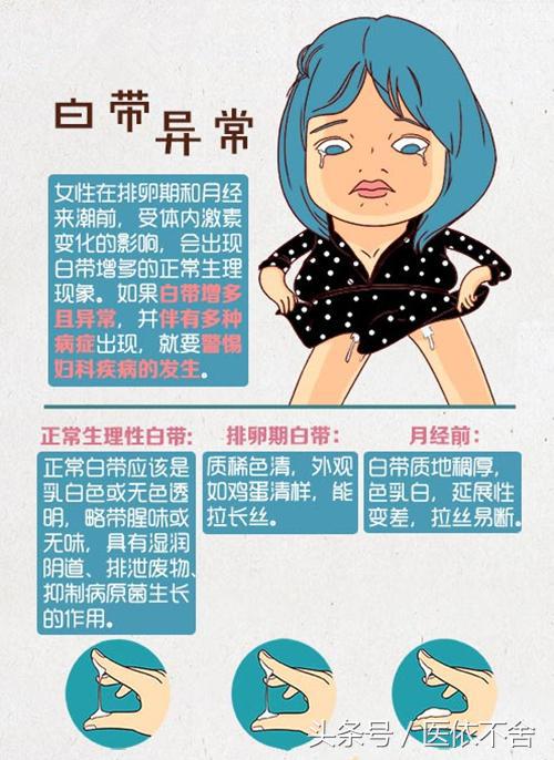 白带异常的各种表现,白带异常什么情况下出现