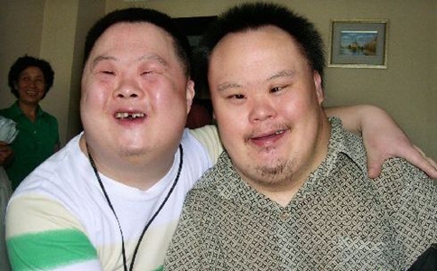 患有唐氏综合征的宝宝,唐氏综合征宝宝越吃越瘦