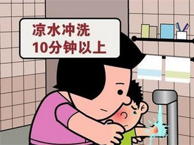 宝宝脚烫伤起泡要不要弄破,小男孩脚烫伤