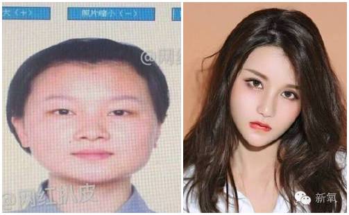 网红做双眼皮变化,整双眼皮成功的网红