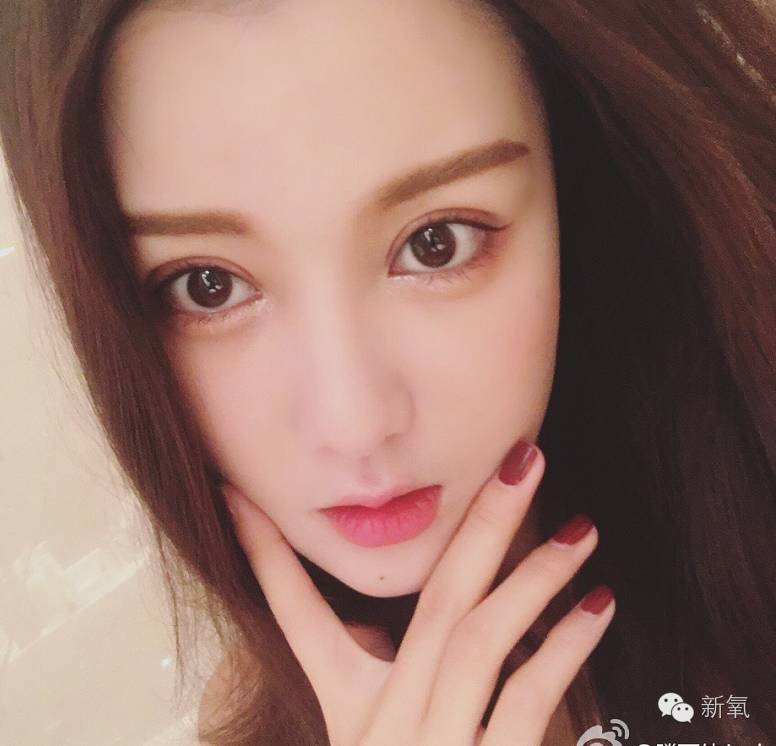 网红做双眼皮变化,整双眼皮成功的网红