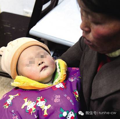 女婴外阴炎怎么造成的,急性幼童外阴炎是什么原因引起的