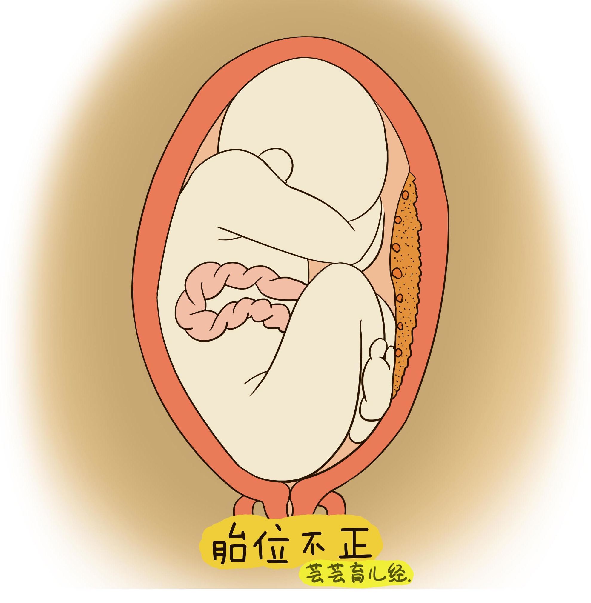 胎儿迟迟不入盆什么原因,胎儿迟迟没有动静