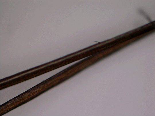 头发总分叉是缺什么营养,头发不分叉是不是营养好