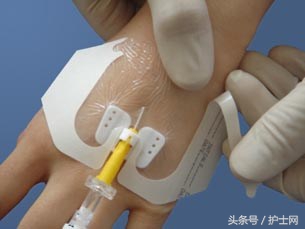留置针患者的健康宣教视频教程,关于留置针科普宣教