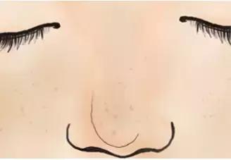 毛孔越挤越大,为啥毛孔越来越粗大越来越多