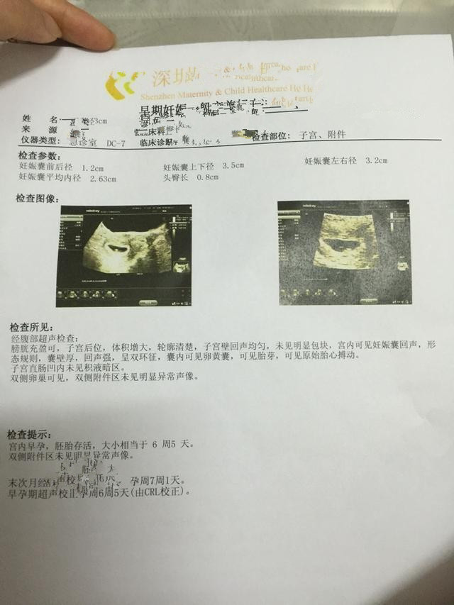 怀孕10周，检查说胚胎停育，要崩溃了！