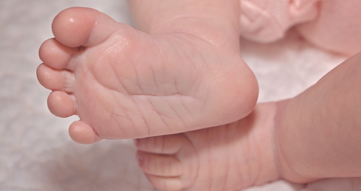 新生儿皮肤干燥皱裂用什么润肤露,宝宝冬天皮肤干燥用什么润肤露好