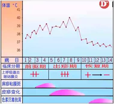 诊断麻疹最快速的方法,麻疹怎么做检测