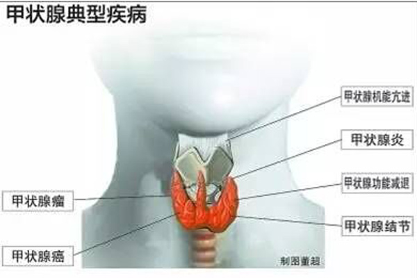 天津总医院甲状腺诊疗中心,天津一中心甲状腺预约挂号
