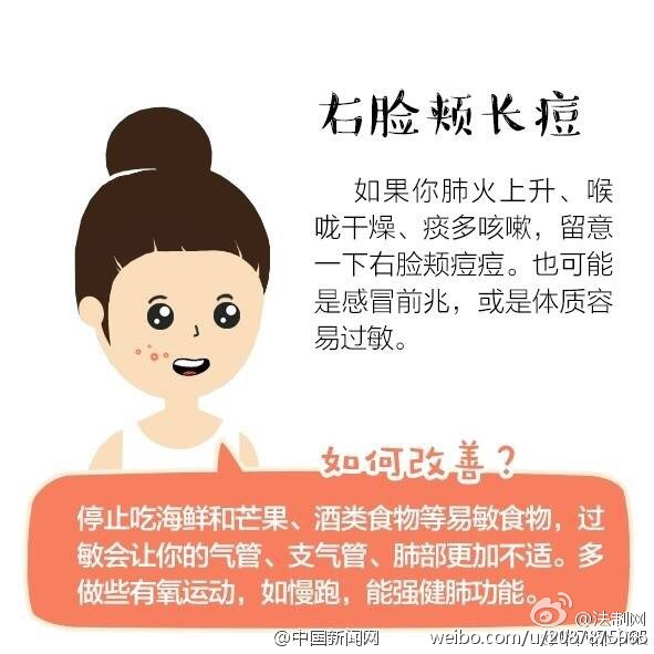 大学生因挤痘引发的一连串事情,挤青春痘导致颅内感染死亡