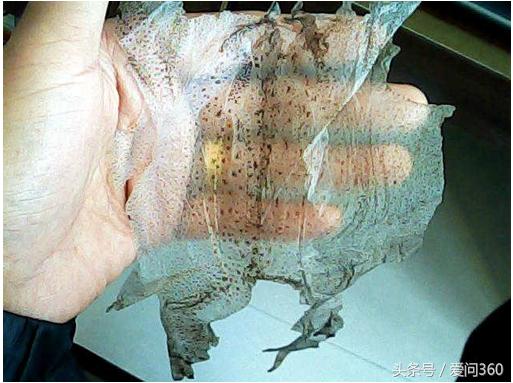 抗癌蟾蜍,最有效的抗癌偏方蟾蜍