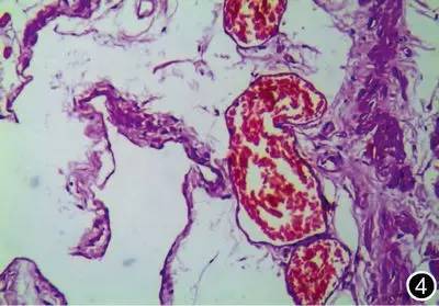 不明原因腹痛胰腺,右上腹痛与胰腺疾病有关系吗
