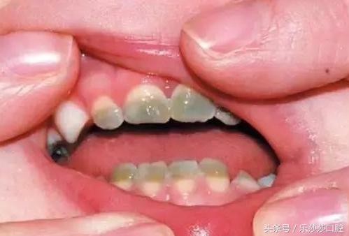牙医能辨别出换过没换过的牙齿吗,牙医见过最好的牙齿是怎么样的