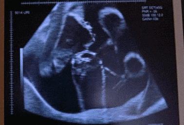 「孕期检查」羊水背后隐藏的秘密，孕妈妈们看后都惊到了！