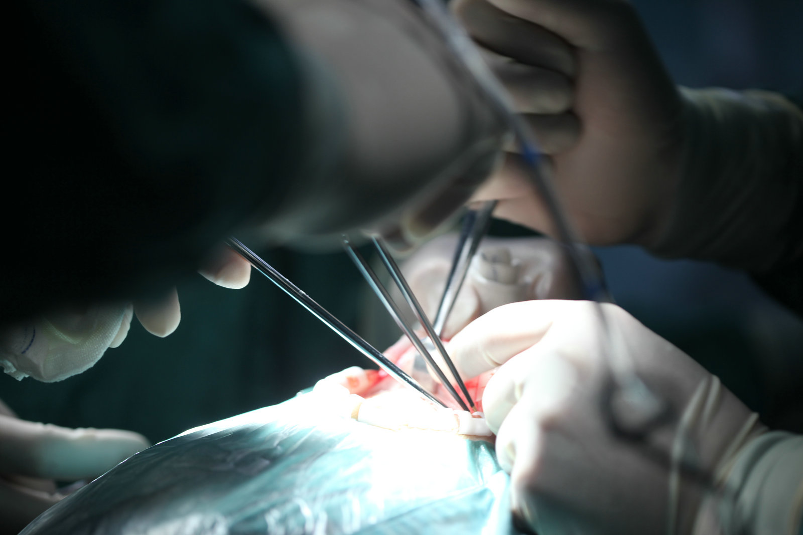 神经外科纪实视频,显微神经外科手术费用