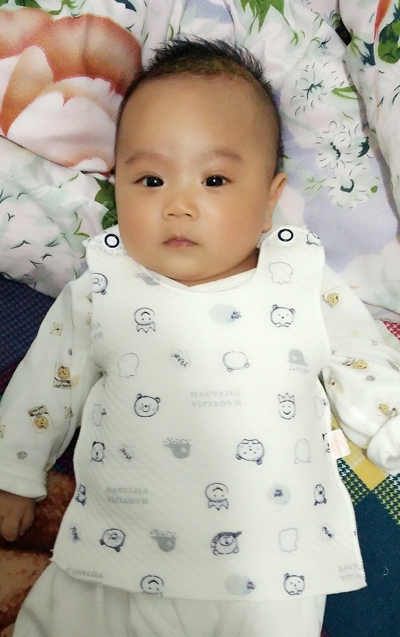 宝宝奶痂几个月才掉,一个月的宝宝长奶痂用什么治疗