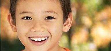 门牙又宽又疏怎么办,门牙牙缝宽怎么矫正