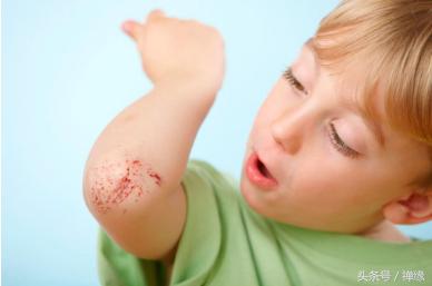 宝宝伤口愈合后怎么护理,宝宝伤口怎么预防感染