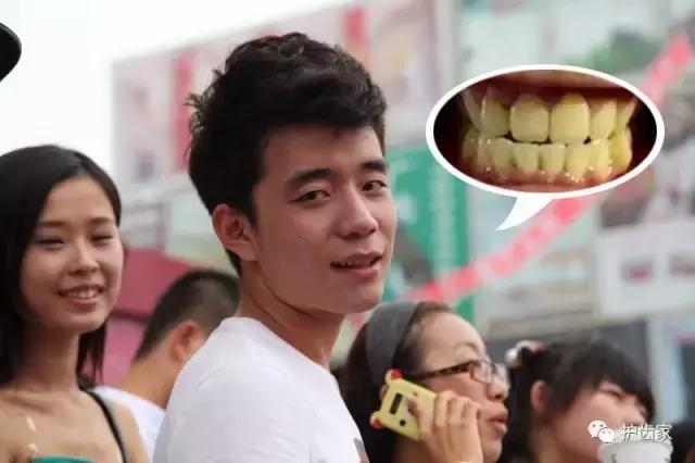 一白遮三丑皮肤白,一白遮三丑一口龅牙毁所有