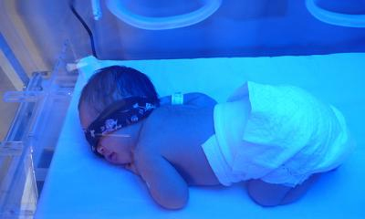 新生儿黄疸，指数多少算正常？什么情况下需要去医院治疗？