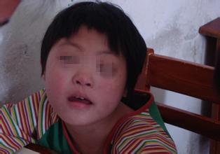 智障女孩遭二次侵害,智障少女惨遭欺凌