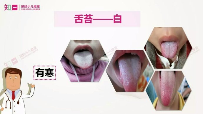 舌苔白厚是什么原因怎么检查,舌苔厚薄如何判断