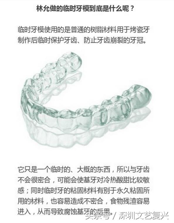 林允整牙效果怎么样,林允整牙后变化图片