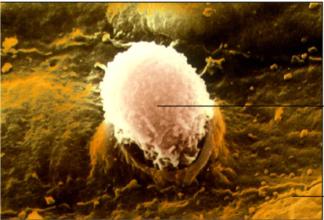 荨麻疹血常规化验单怎么看,凝血常规化验单怎么看