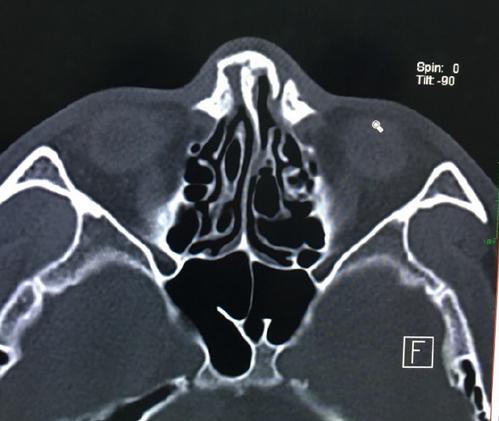 一龙一战成名,一龙vs播求一龙赛后怎么说
