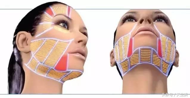 超声刀怎么样啊 (超声刀分享)