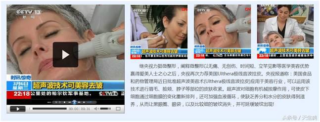 超声刀怎么样啊 (超声刀分享)