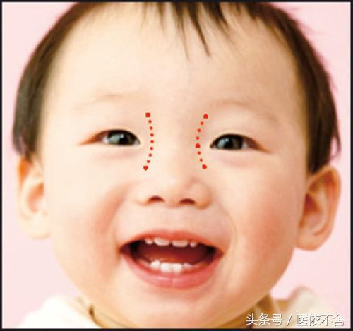 小宝宝眼睛斜视引斜颈怎么办,小宝宝眼睛对眼