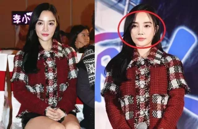 整牙=整容？看杨幂、刘涛、高圆圆为你亲身示范！