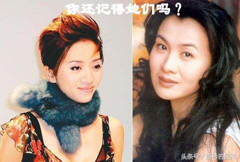 早期发现宫颈癌的有效办法,宫颈癌的早期信号30分钟见效