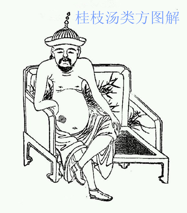 慢性肠炎受寒肚子痛怎么治疗,慢性肠炎引起的腹痛是什么感觉