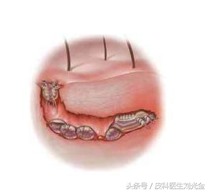 揭开谜团的真实事件,揭开皮肤病的真相