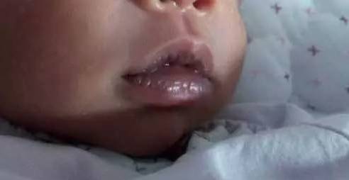 一旦嘴唇变成这种颜色就要警惕,嘴唇发黄要警惕这是一种常见疾病