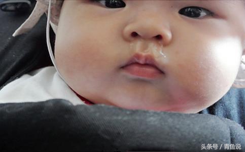 孩子流鼻涕怎么看是风热还是风寒,妈妈必须知道孩子流鼻涕的原因