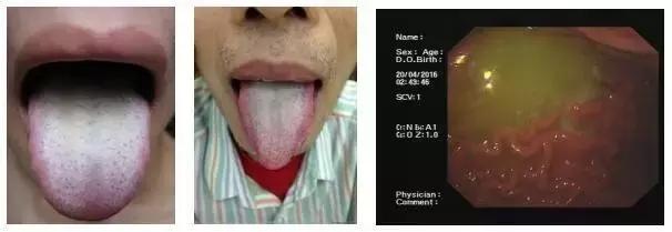 舌苔辨证图谱望舌识病,揭秘舌苔图谱轻松自诊