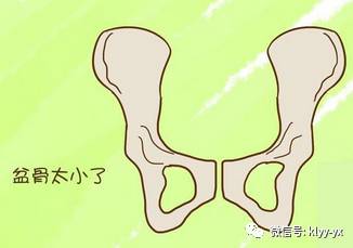 孕妇骨盆检查是怎么操作的,孕妇骨盆测量能确定是否顺产吗