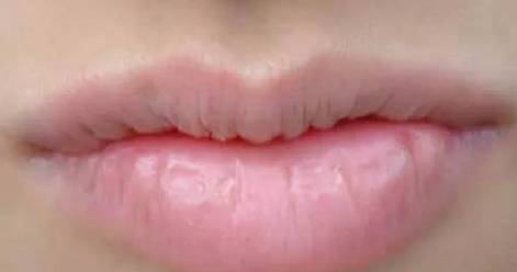 一旦嘴唇变成这种颜色就要警惕,嘴唇发黄要警惕这是一种常见疾病