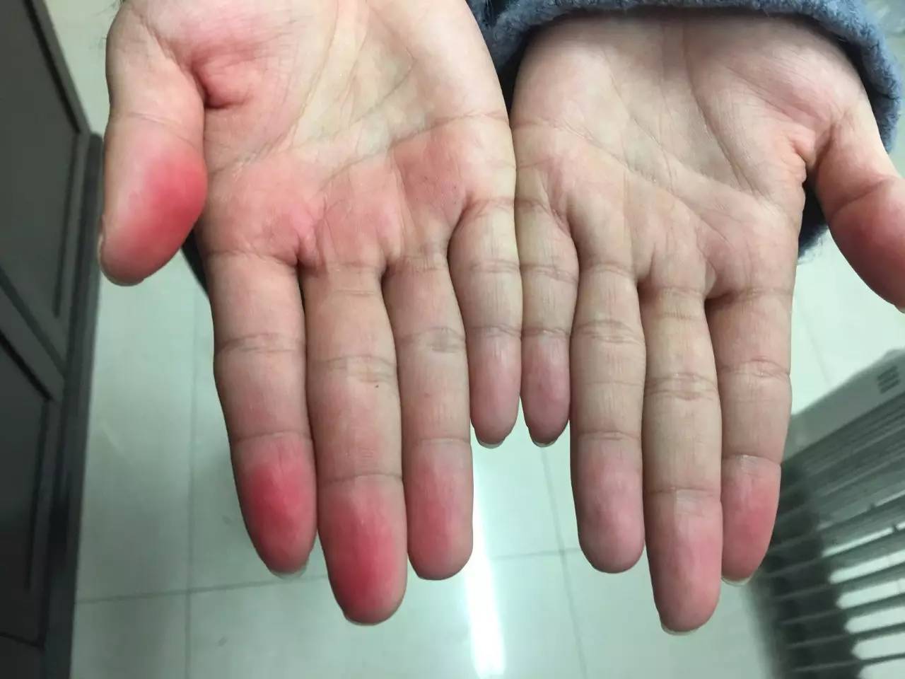 「微快讯」克拉玛依市民买到疑似染色的砂糖橘市场监管局已介入调查