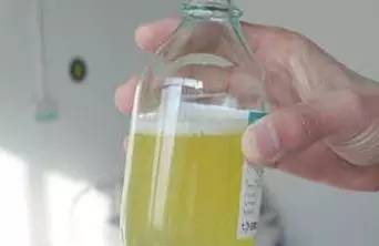 「健康」尿常规报告上这几个指标，告诉你肾好不好！