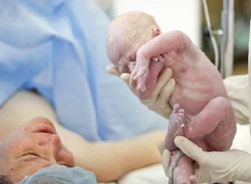 顺产生孩子一般需要多久,女人生孩子是顺产痛还是剖腹产痛