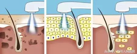 郑医生科普小知识,郑医生健康小知识