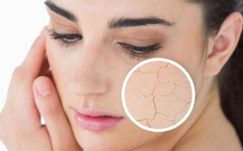 如何预防衰老不再变黄脸婆,预防衰老从现在开始